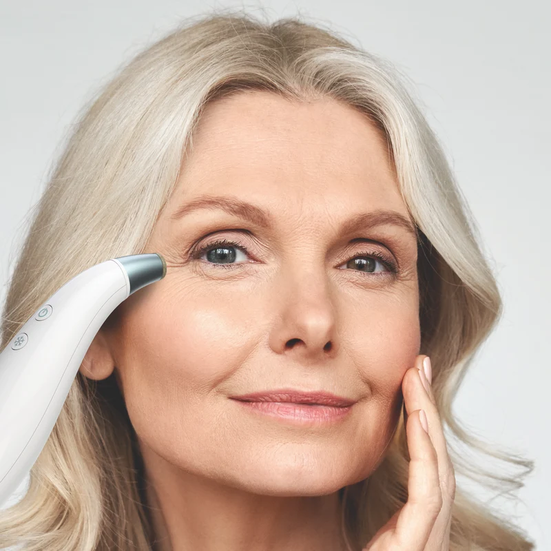 Homedics Radiance Microdermabrasion with Cooling