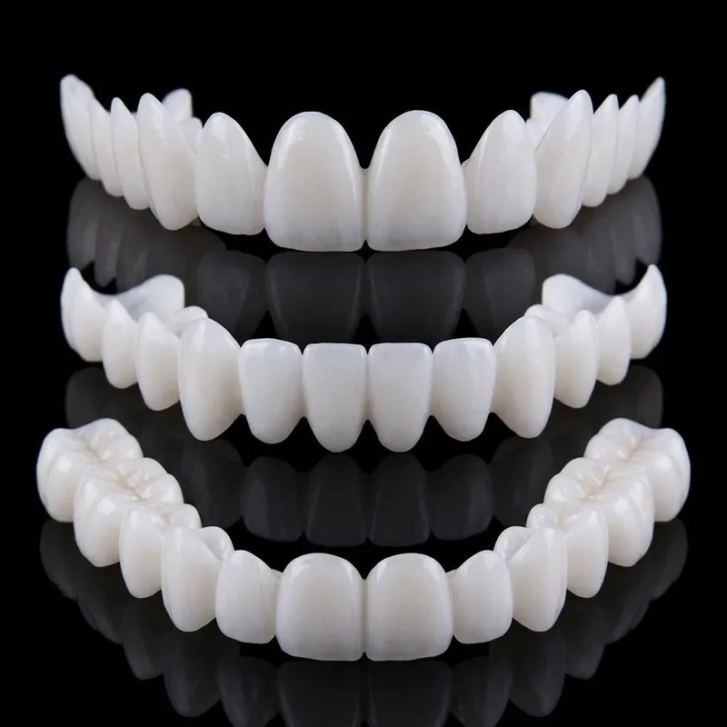 SmileCover | Facettes Dentaires Amovibles Cosmétique Snap-On