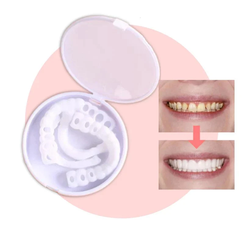 Facette Dentaire Instantanée pour Sourire Naturel